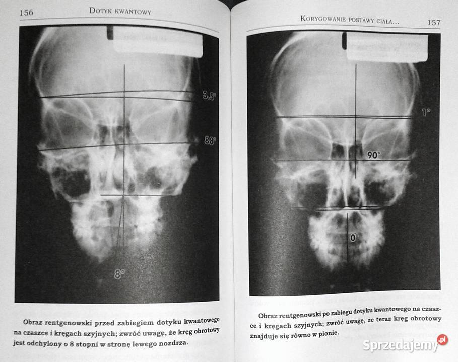 Dotyk kwantowy Uzdrawiająca moc dłoni Richard Rok wydania 2005 Chełm