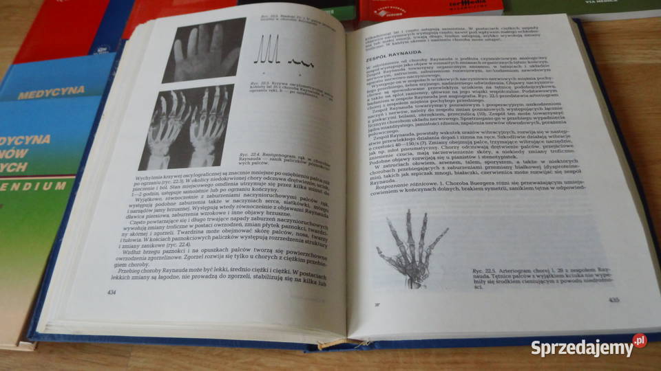 Zdrowie Nadciśnienie Choroby serca Zawał serca wielkopolskie Radzewice sprzedam