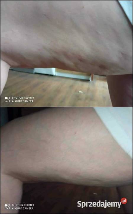 Termokrem ujędrniający Skuteczna pielęgnacja podlaskie Hajnówka