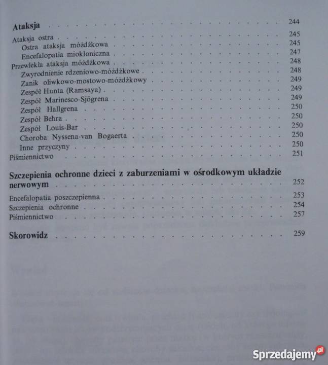 WYBRANE ZAGADNIENIA Z NEUROLOGII DZIECIĘCEJ medycyna, nauki medyczne Zielona Góra