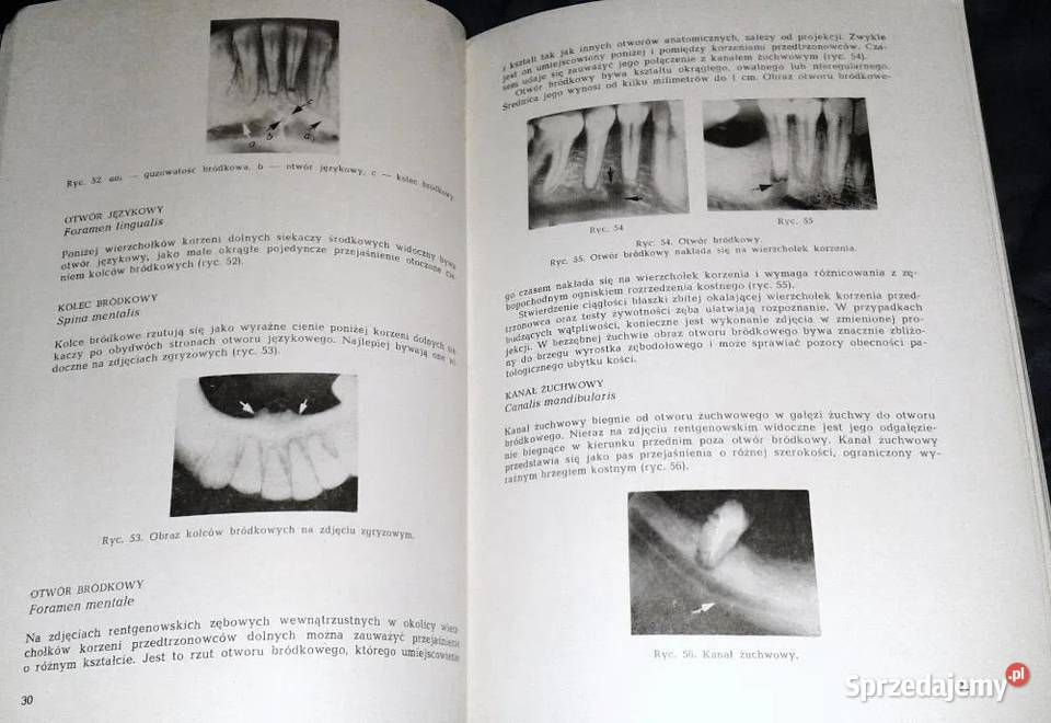 Zarys rentgenodiagnostyki stomatologicznej Z Chełm sprzedam