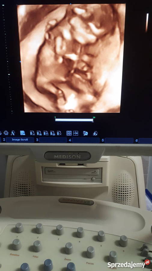 APARAT USG MEDISON X8 4 sondy pomorskie Gdańsk sprzedam