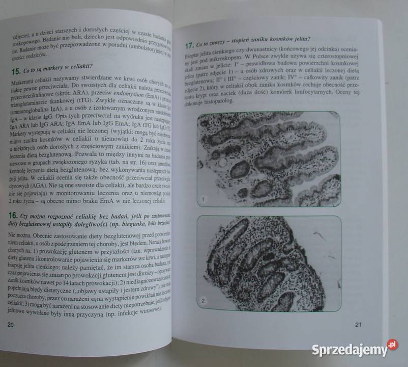 Dieta bezglutenowa i bezmleczna dzieci i łódzkie Łódź