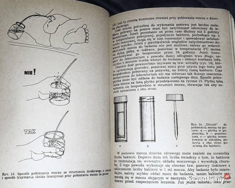 Choroby nerek u dzieci Teresa Wyszyńska