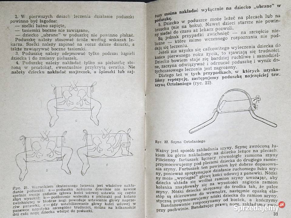 Wrodzone zwichnięcie biodra jest uleczalne Karol Chełm