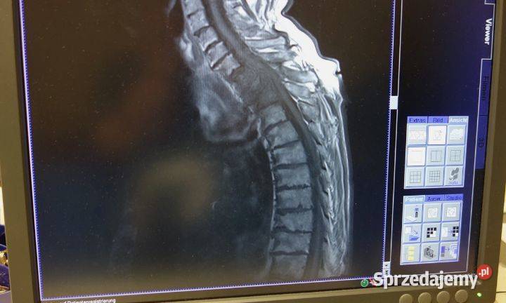 Używany system rezonansu magnetycznego Siemens Nowy Sącz