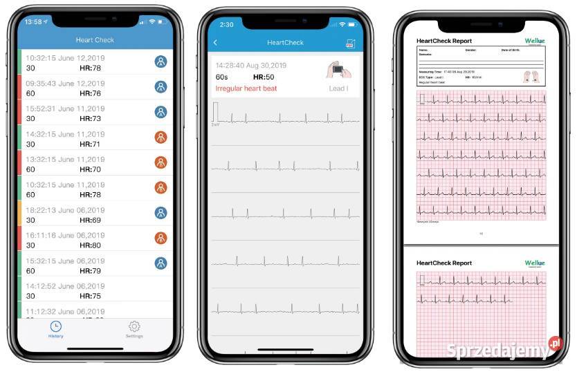 Przenośne Mobilne EKG Aparat Monitor Pulsebit Myszków sprzedam