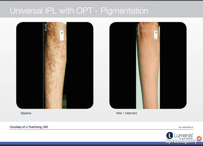 M22 Luenis Coherent Polska małopolskie Kraków