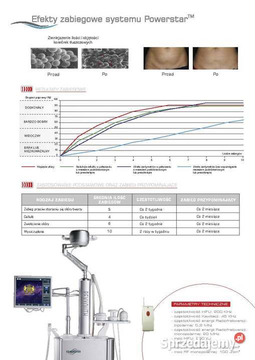 Powerstar endermologia z RF HIFU kawitacja RF opolskie Prudnik