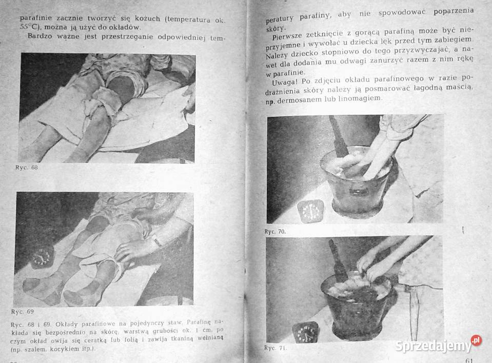 Reumatoidalne zapalenie stawów u dzieci W Rok wydania 1981 lubelskie Chełm sprzedam