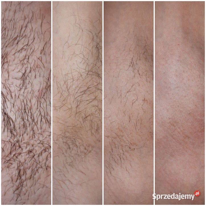 Depilacja cukrowa gładka skóra na 4 tygodni Chorzów