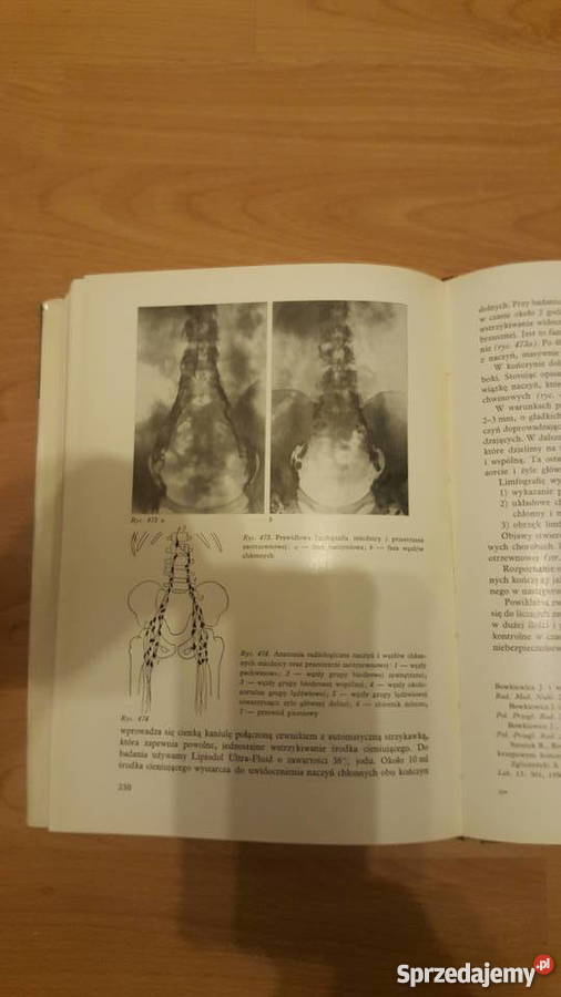 Radiologia SL Zgliczyński Łódź