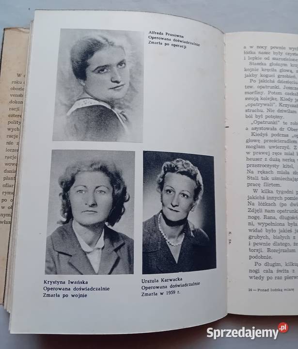 Ponad ludzką miarę Wspomnienia operowanych z Rav Koźminek