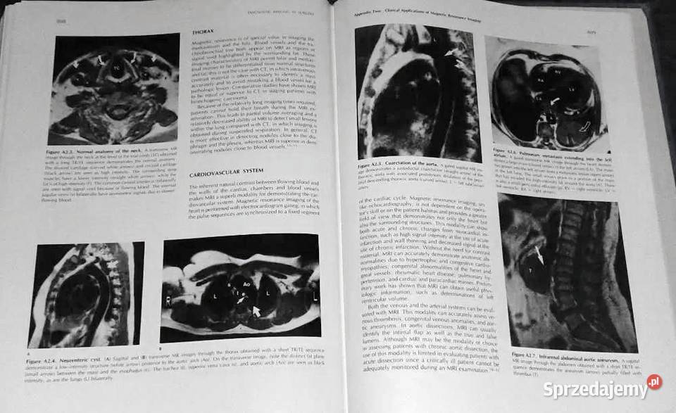 Diagnostic Imaging in Surgery Ronald Eisenberg Chełm