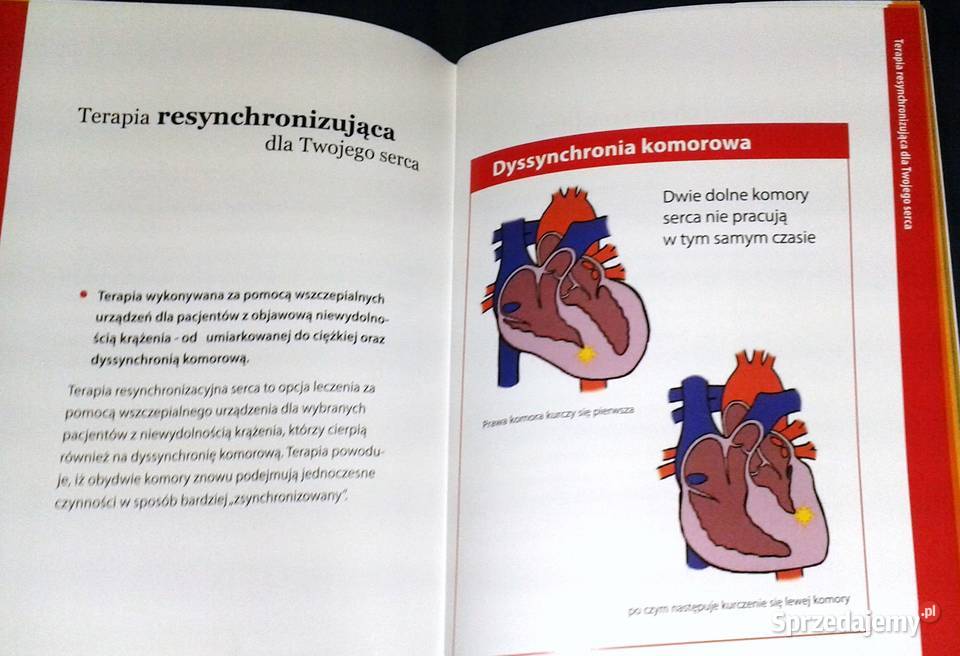 Zrozumienie terapii resynchronizacji serca w miękka Chełm
