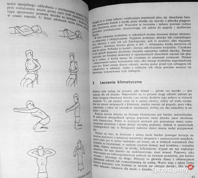 Alergia u dzieci Danuta ChmielewskaSzewczyk