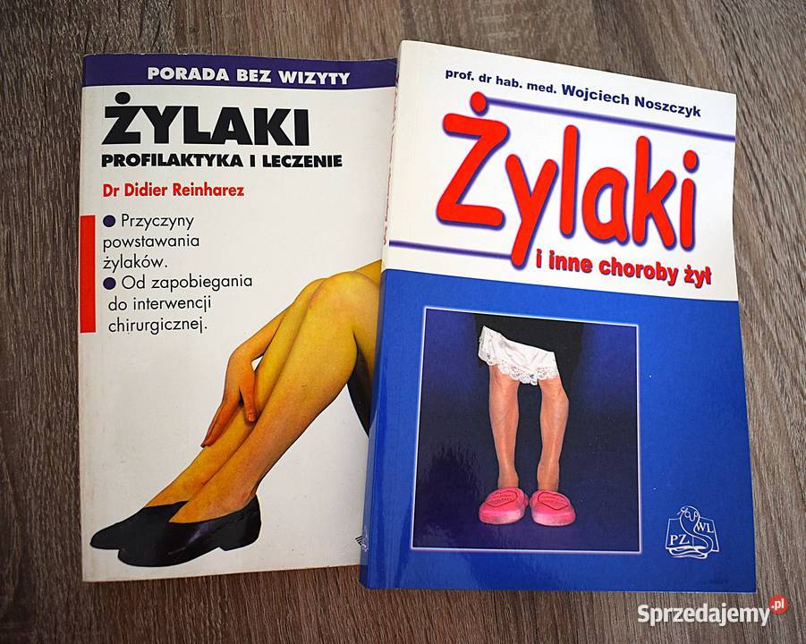 Żylaki leczenie profilaktyka przyczyny objawy zdrowie, pierwsza pomoc Chełmno