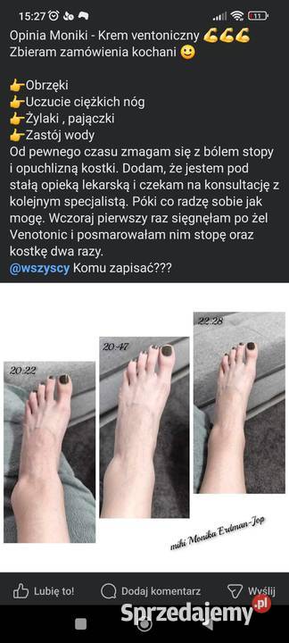 Venotonic żel chłodzący na zmęczone nogi żylaki podlaskie