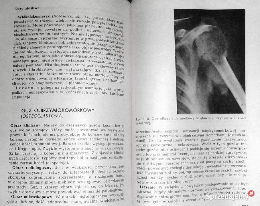 Onkologia Seria II Tom 5 Anna Madejczyk lubelskie Chełm