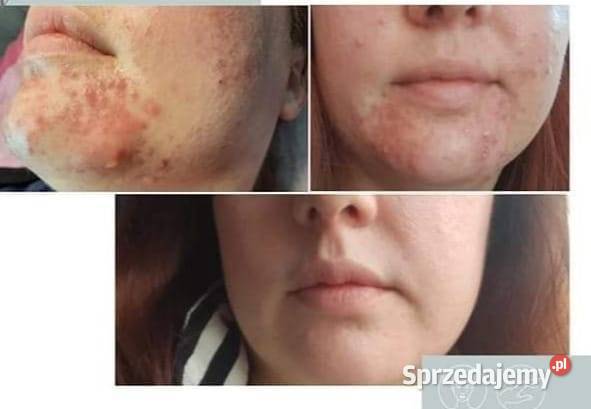 LARENS CBD Special Skin Therapy Skóra warmińsko-mazurskie Działdowo