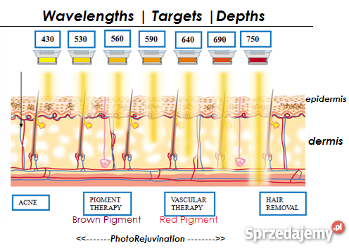 M22 Luenis Coherent Polska Kraków