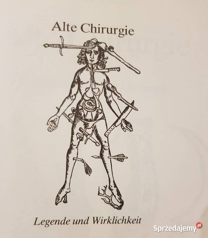 Alte Chirurgie Legende Wirklichkeit Detlef Rster świętokrzyskie Kielce
