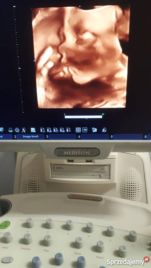 APARAT USG MEDISON X8 4 sondy Sprzęt medyczny Gdańsk