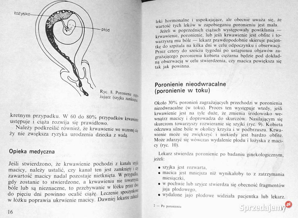 poronieniu Anne Stonehouse Bruce Sutherland Chełm