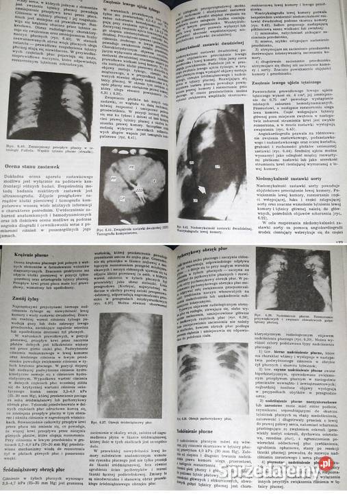 Nauka o chorobach wewnętrznych Tom 1 Witold Chełm