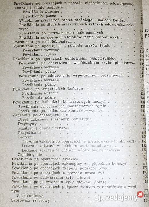 Powikłania operacjach naczyń krwionośnych H Książki i Podręczniki lubelskie Chełm sprzedam