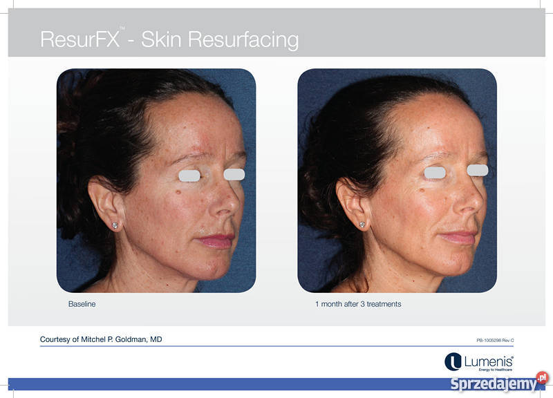 M22 Luenis Coherent Polska Kraków sprzedam