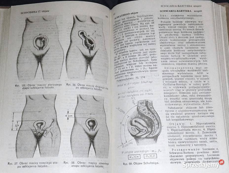 Leksykon zespołów i objawów w ginekologii i
