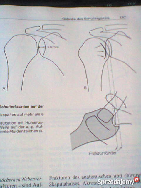 Gelenke Wirbelverbindungen Kultura i Rozrywka Szczecin