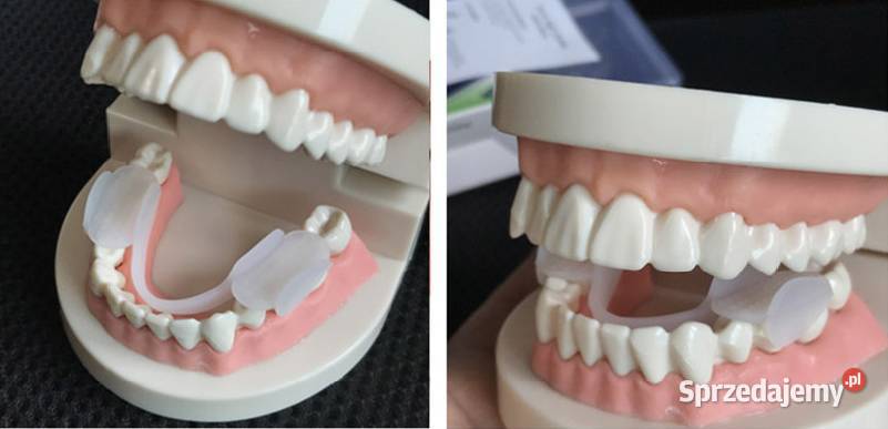 Szyna relaksacyjna na zgrzytanie Bruksizm 2x mazowieckie Płock