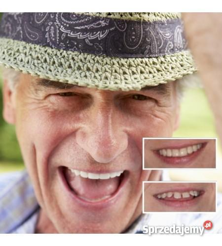 RÓWNE I WYBIELONE ZĘBY W PIĘĆ MINUT sprzedam