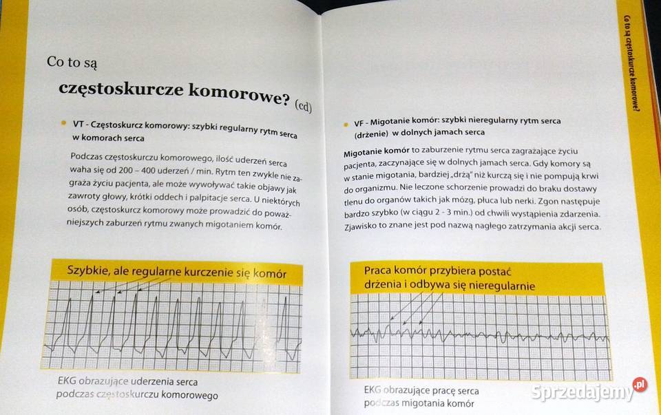 Zrozumienie terapii resynchronizacji serca w Chełm