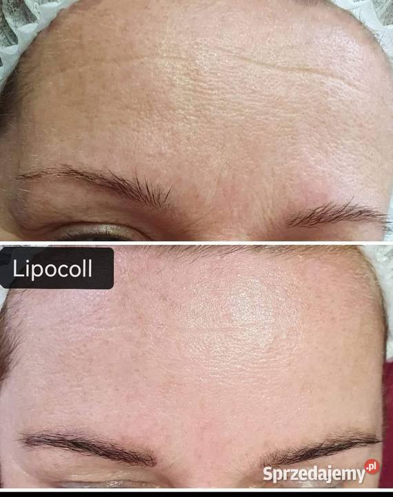 LARENS LipoColl HA Hydro Serum Pielęgnacja warmińsko-mazurskie Działdowo