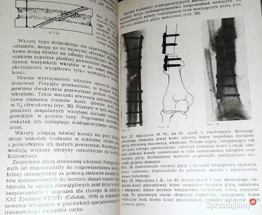 Niepowodzenia w leczeniu uszkodzeń narządów Chełm
