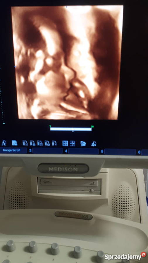 APARAT USG MEDISON X8 4 sondy Zdrowie i Uroda