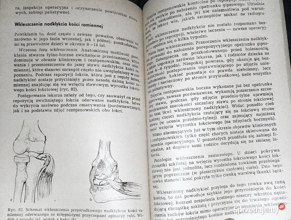 Niepowodzenia w leczeniu uszkodzeń narządów Książki i Podręczniki Chełm