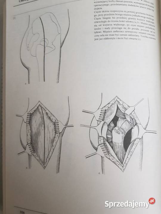 Chirurgia operacyjna atlas zabiegów medycyna medycyna, nauki medyczne sprzedam