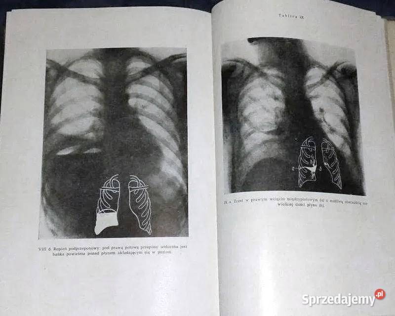 Nauka o chorobach wewnętrznych Tom 2 Witold E lubelskie