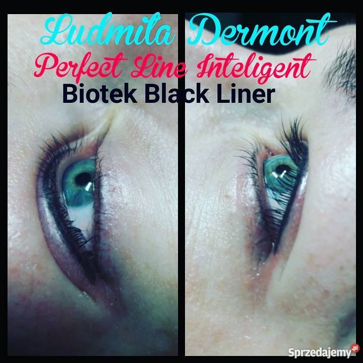 PERMANENTNY MAKIJAŻ I MEZOTERAPIA MIKROIGLOWA Suwałki