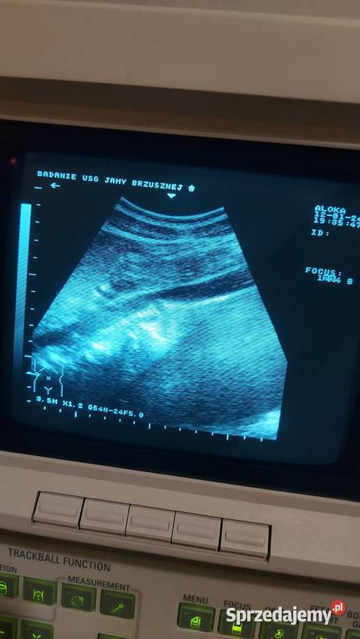 Aparat ultrasonograficzny USG drukarka głowice