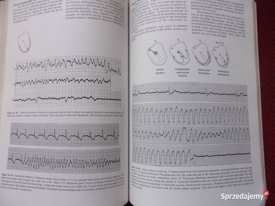 Zasady Elektrokardiografia kliniczna Wydanie 10 tradycyjny podręcznik Warszawa