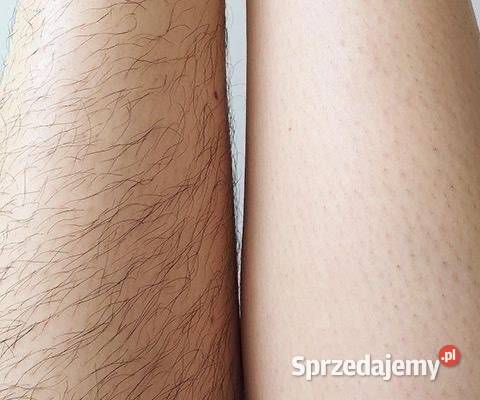 Dopilacja cukrowa Naturalna gładkość bez Chorzów sprzedam