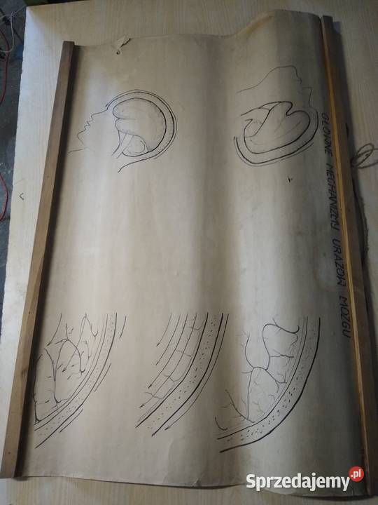 rycina plakat mózg mazowieckie Warszawa