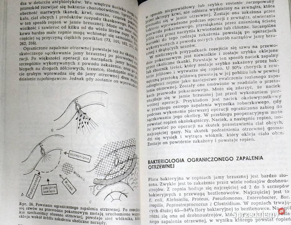 Wczesne powtórne otwarcie jamy brzusznej Leszek Chełm