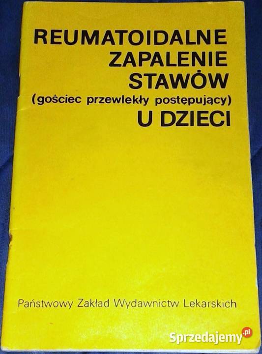 Reumatoidalne zapalenie stawów u dzieci W