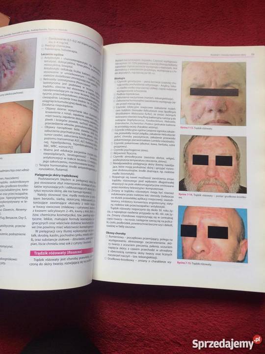 Dermatologia kosmetologów Żary sprzedam